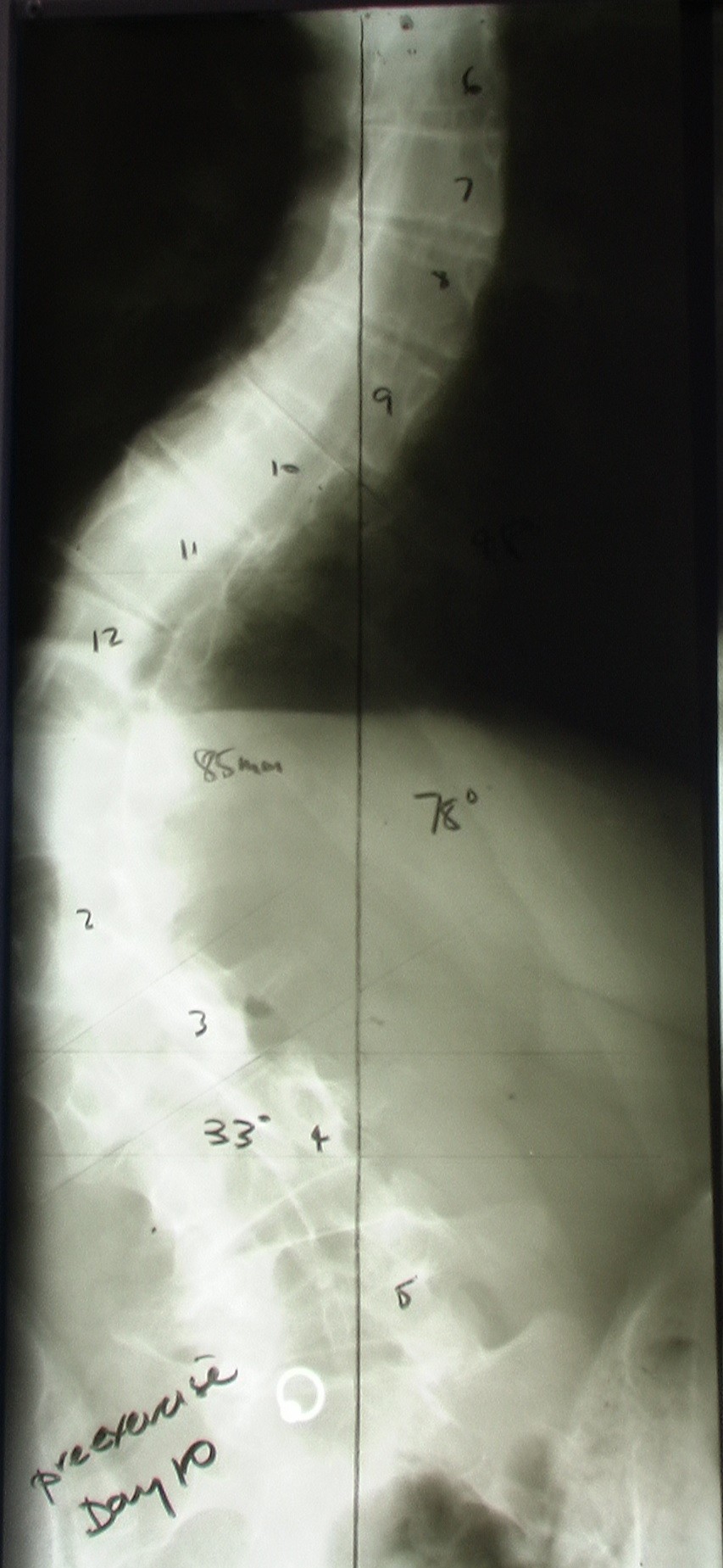case study on x ray